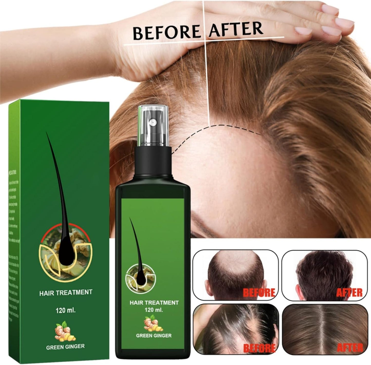 Hair Growth Serum Anti-Hair Loss